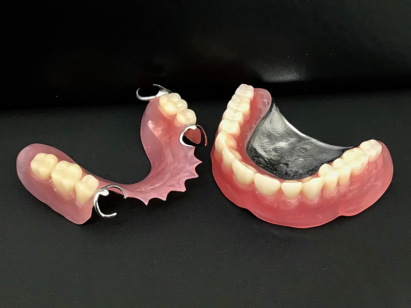 ブリッジ・義歯（入れ歯）